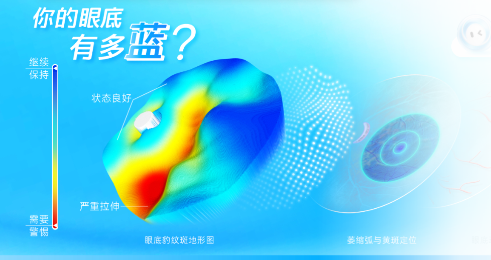 脉络膜厚度：近视进展的眼底核心靶点--从血流机制到各类防控手段的再思考